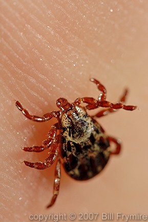 American Dog tick on human skin