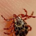 American Dog tick on human skin